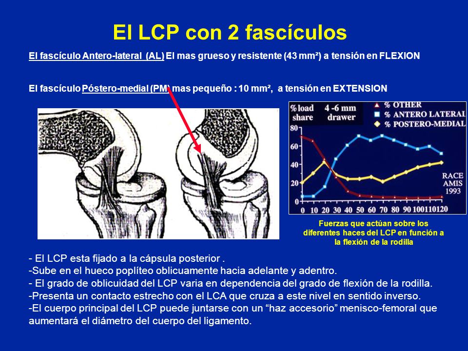 El LCP con 2 fascículos - El LCP esta fijado a la cápsula posterior .