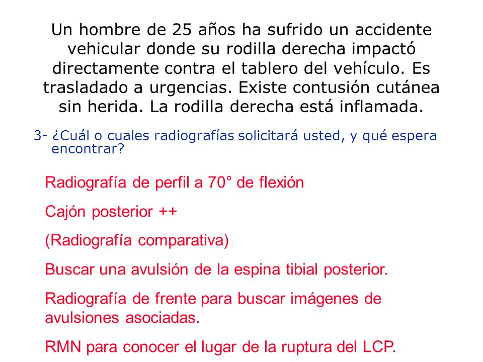 Radiografía de perfil a 70° de flexión Cajón posterior ++
