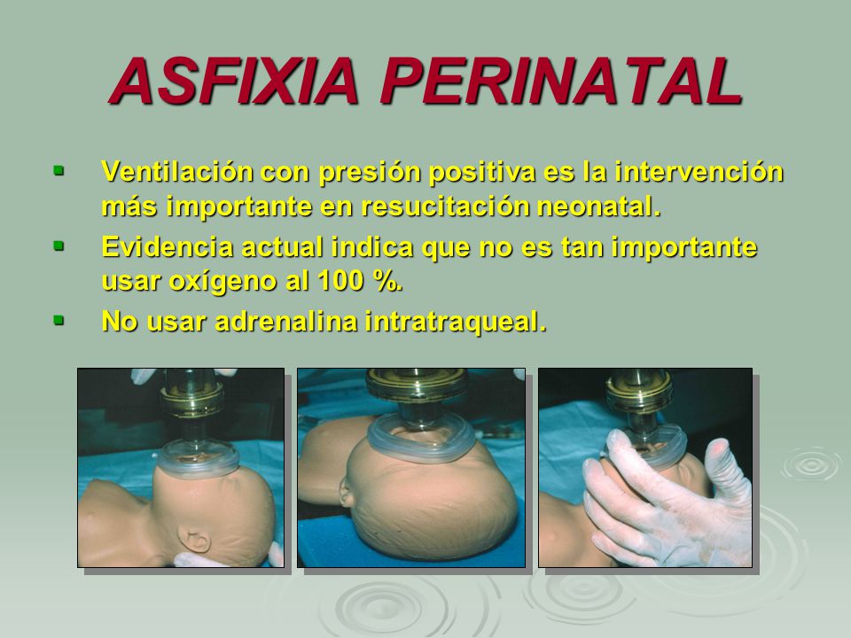ASFIXIA PERINATAL Ventilación con presión positiva es la intervención más importante en resucitación neonatal.