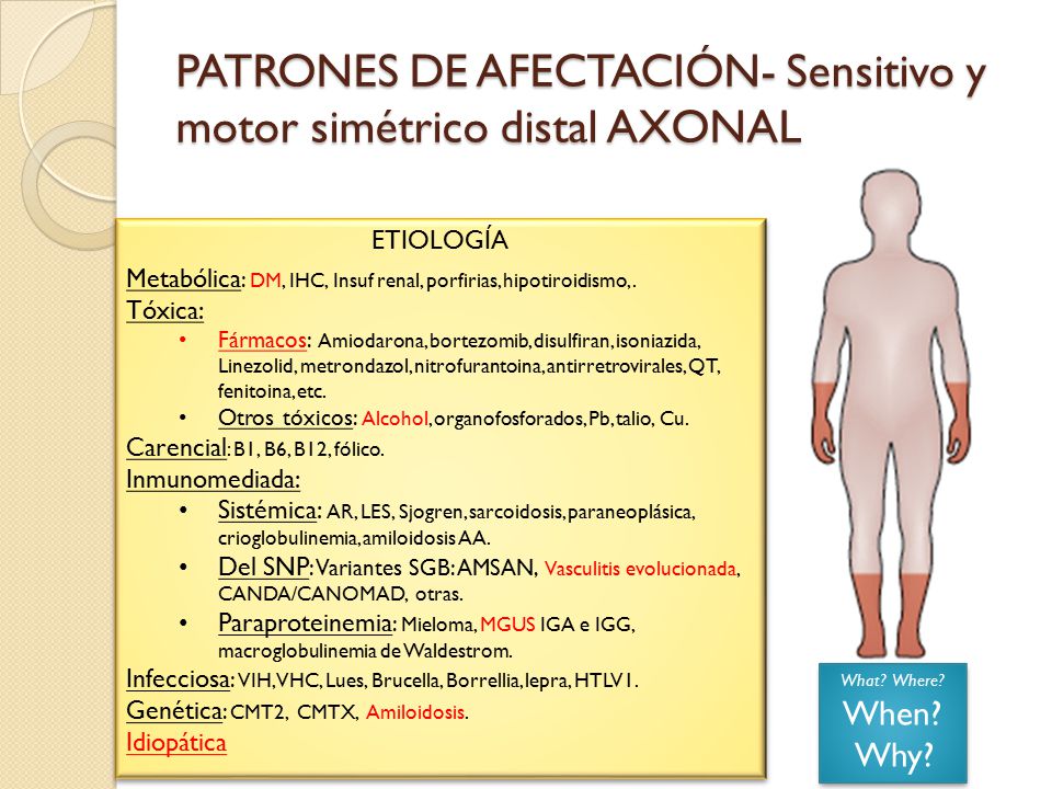 PATRONES DE AFECTACIÓN- Sensitivo y motor simétrico distal AXONAL