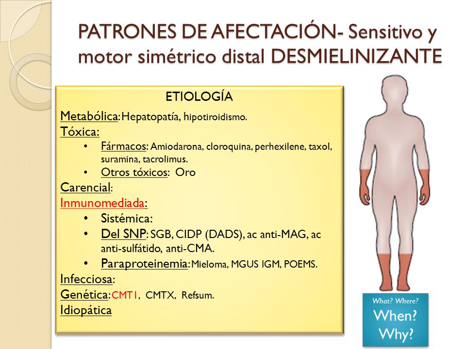 PATRONES DE AFECTACIÓN- Sensitivo y motor simétrico distal DESMIELINIZANTE