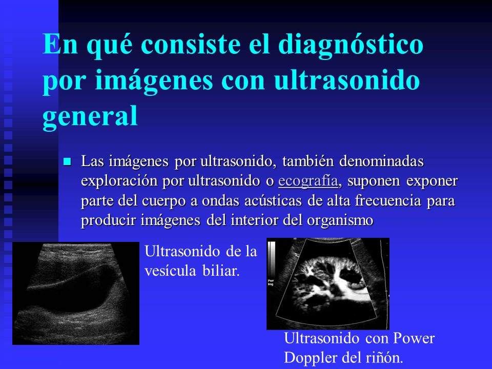 En qué consiste el diagnóstico por imágenes con ultrasonido general