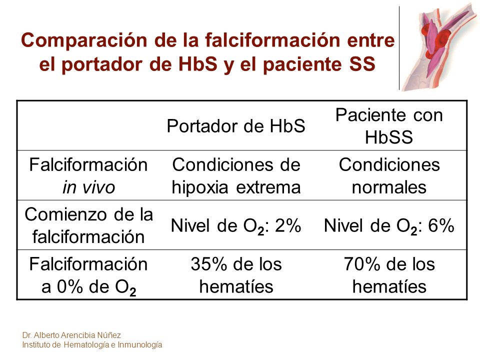 Comparación de la falciformación entre el portador de HbS y el paciente SS