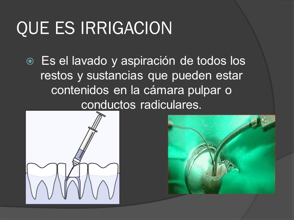 QUE ES IRRIGACION Es el lavado y aspiración de todos los restos y sustancias que pueden estar contenidos en la cámara pulpar o conductos radiculares.