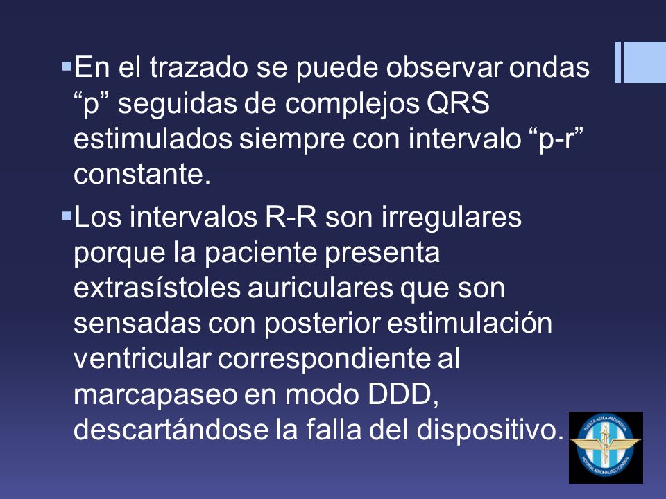 En el trazado se puede observar ondas p seguidas de complejos QRS estimulados siempre con intervalo p-r constante.
