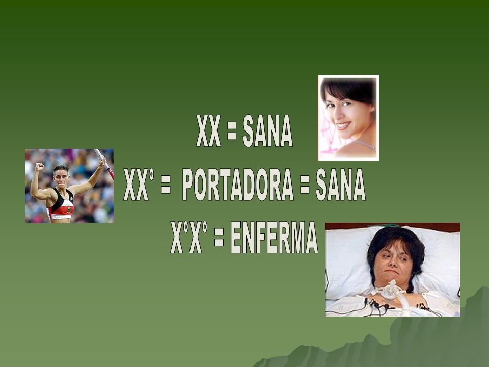 XX = SANA XX° = PORTADORA = SANA X°X° = ENFERMA