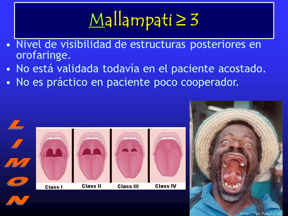Mallampati ≥ 3 Nivel de visibilidad de estructuras posteriores en orofaringe. No está validada todavía en el paciente acostado.