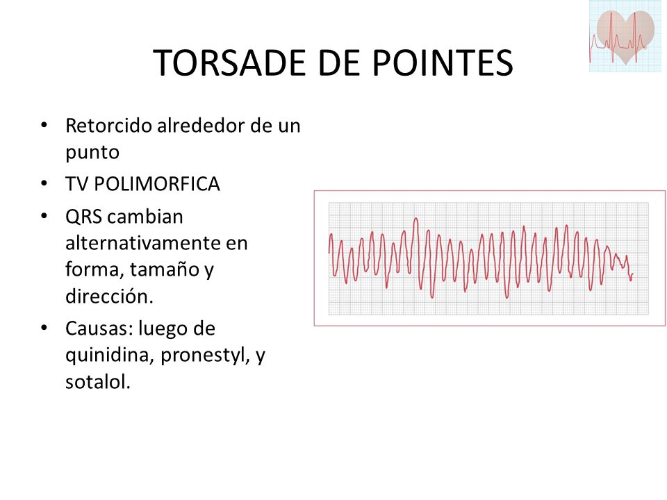 TORSADE DE POINTES Retorcido alrededor de un punto TV POLIMORFICA