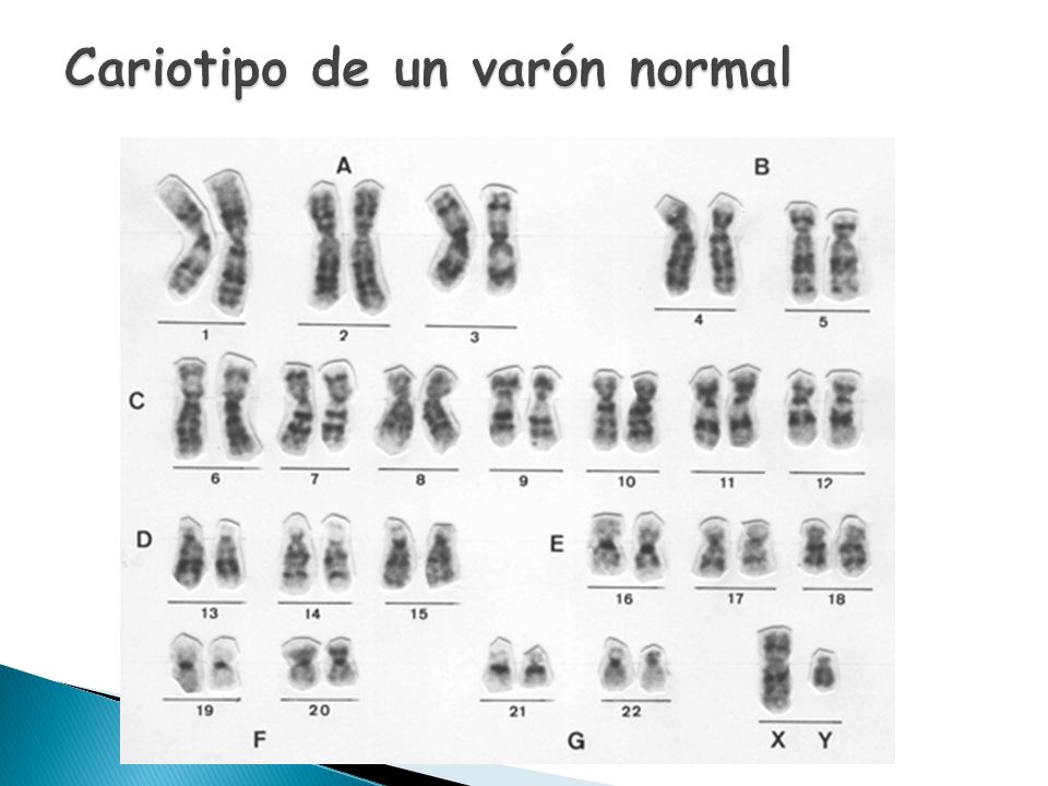 Cariotipo de un varón normal