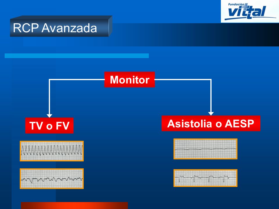 RCP Avanzada Monitor Asistolia o AESP TV o FV