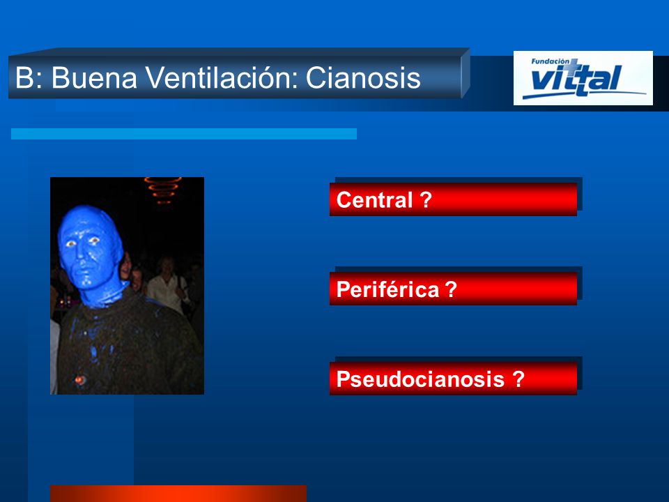 B: Buena Ventilación: Cianosis
