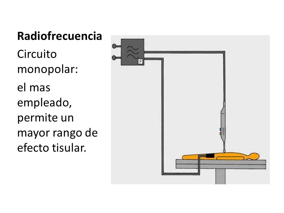 Radiofrecuencia Circuito monopolar: el mas empleado, permite un mayor rango de efecto tisular.