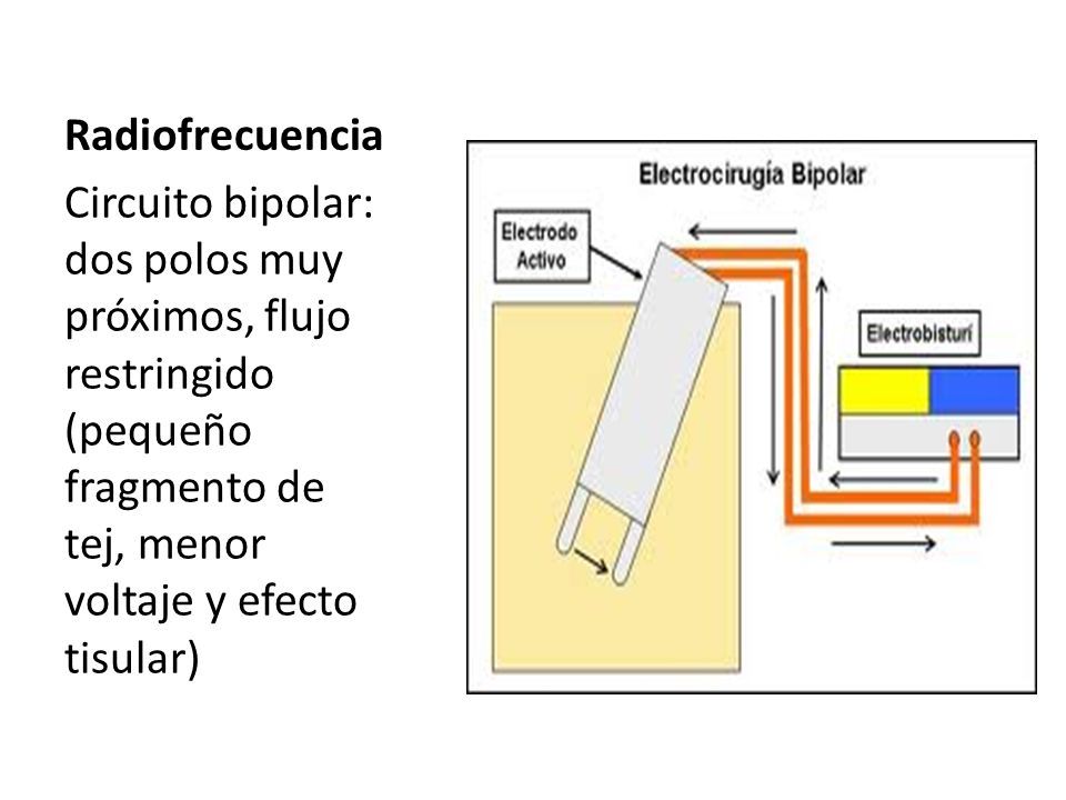 Radiofrecuencia Circuito bipolar: dos polos muy próximos, flujo restringido (pequeño fragmento de tej, menor voltaje y efecto tisular)