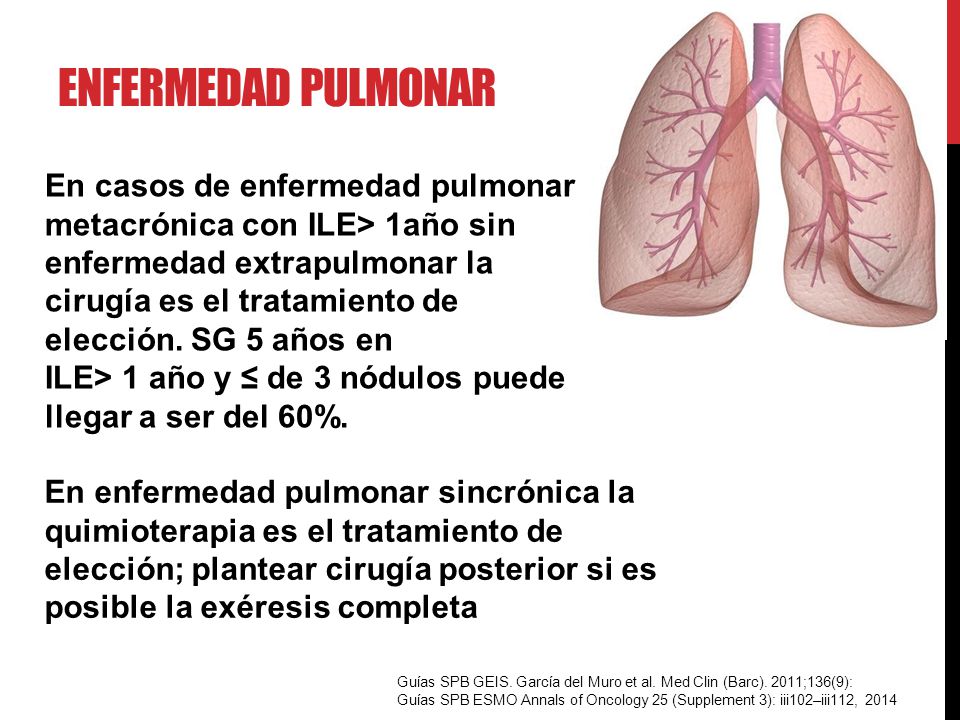 Enfermedad pulmonar