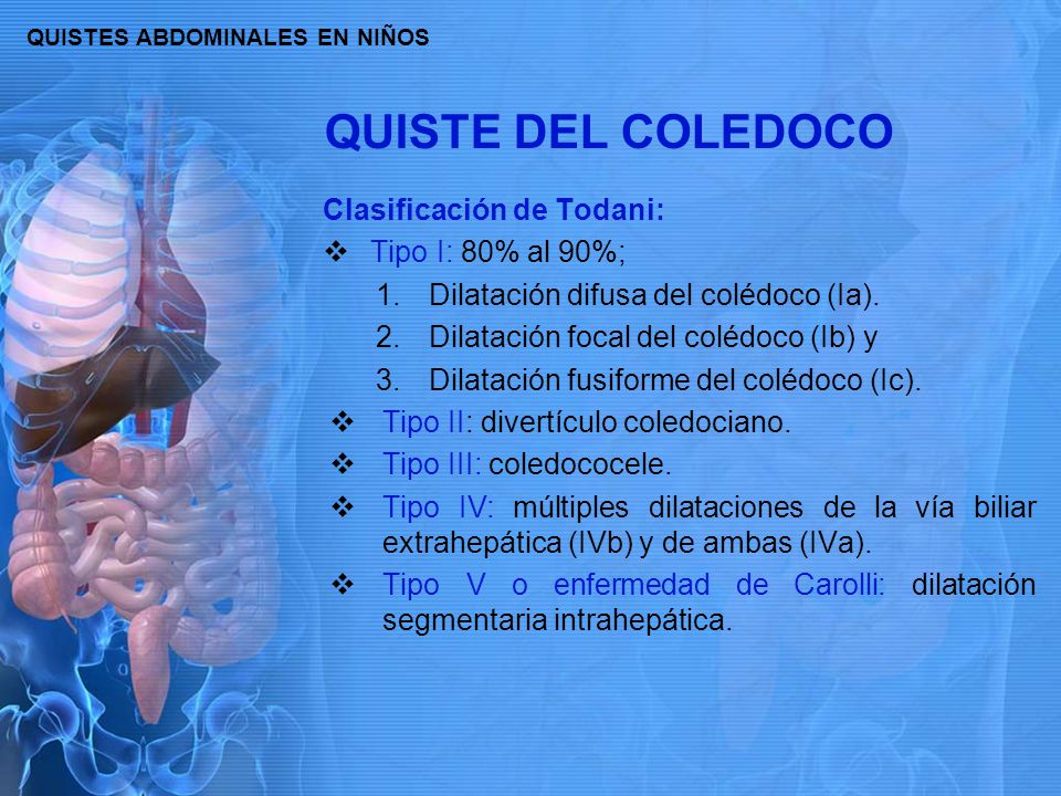 QUISTES ABDOMINALES EN NIÑOS