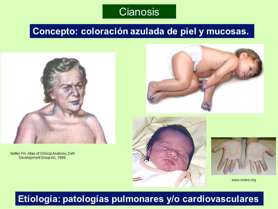 Netter FH: Atlas of Clinical Anatomy, DxR Development Group Inc, 1999.