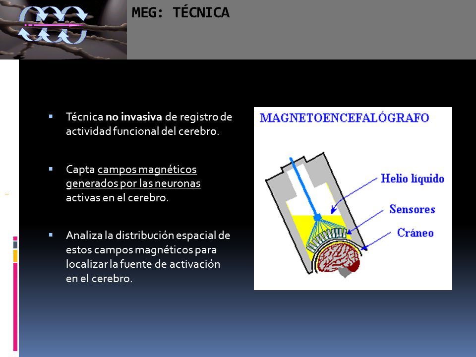 MEG: TÉCNICA Técnica no invasiva de registro de actividad funcional del cerebro.