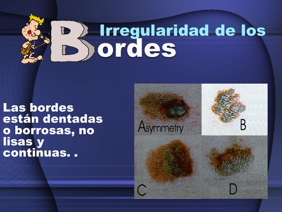 La Verdad Sobre la Protección Contra el Sol: ¡Cuidando Tu Piel!