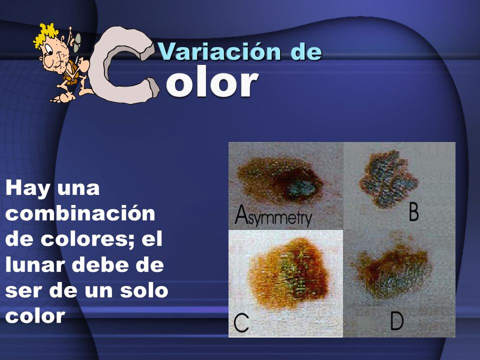 La Verdad Sobre la Protección Contra el Sol: ¡Cuidando Tu Piel!