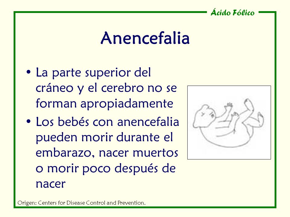 Anencefalia La parte superior del cráneo y el cerebro no se forman apropiadamente.