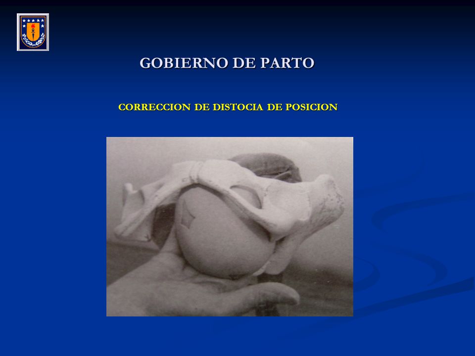 GOBIERNO DE PARTO CORRECCION DE DISTOCIA DE POSICION