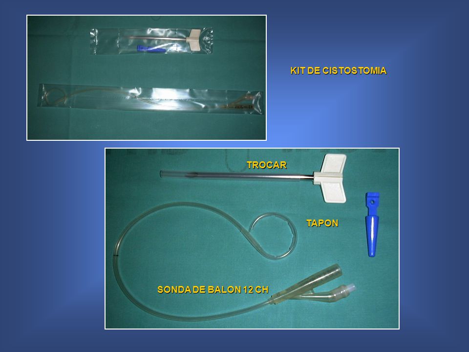 KIT DE CISTOSTOMIA TROCAR TAPON SONDA DE BALON 12 CH