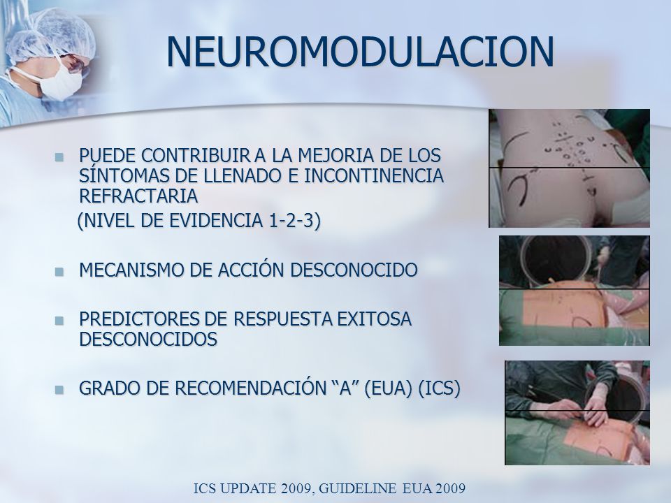 NEUROMODULACION PUEDE CONTRIBUIR A LA MEJORIA DE LOS SÍNTOMAS DE LLENADO E INCONTINENCIA REFRACTARIA.