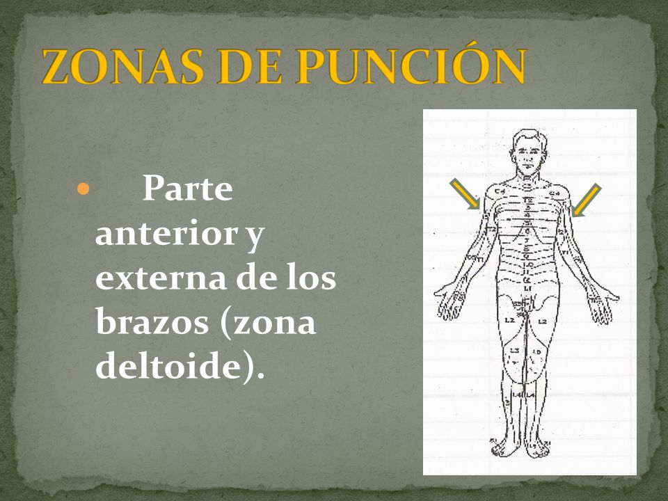 ZONAS DE PUNCIÓN Parte anterior y externa de los brazos (zona deltoide).