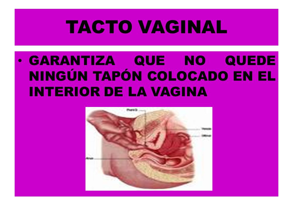 TACTO VAGINAL GARANTIZA QUE NO QUEDE NINGÚN TAPÓN COLOCADO EN EL INTERIOR DE LA VAGINA