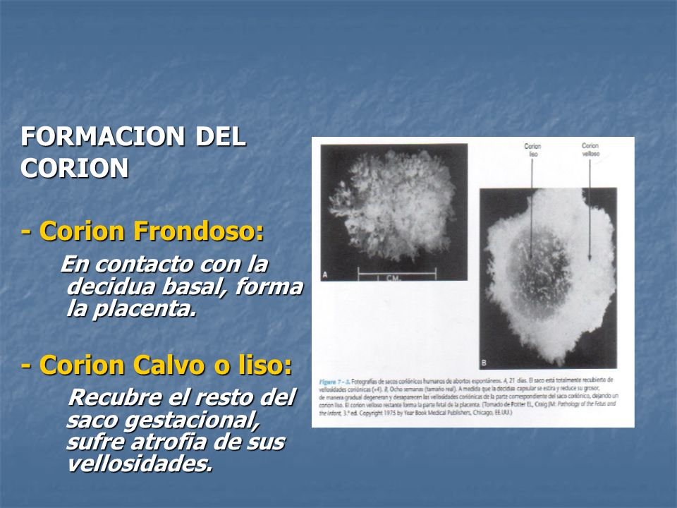 FORMACION DEL CORION. - Corion Frondoso: En contacto con la decidua basal, forma la placenta. - Corion Calvo o liso: