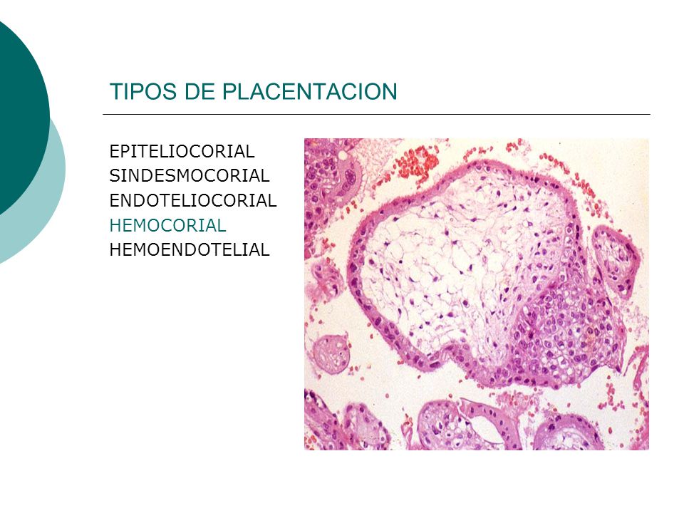 TIPOS DE PLACENTACION EPITELIOCORIAL SINDESMOCORIAL ENDOTELIOCORIAL