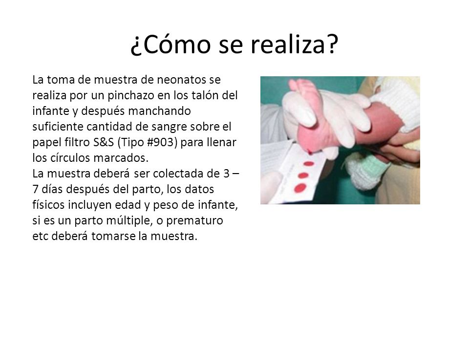 ¿Cómo se realiza
