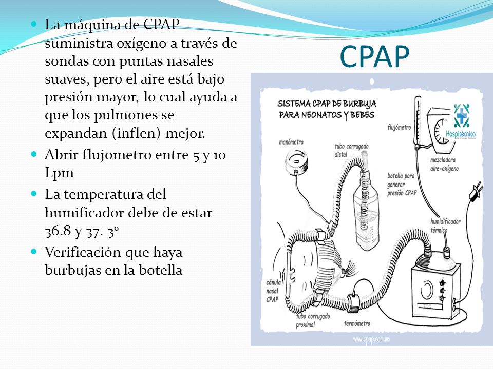 La máquina de CPAP suministra oxígeno a través de sondas con puntas nasales suaves, pero el aire está bajo presión mayor, lo cual ayuda a que los pulmones se expandan (inflen) mejor.