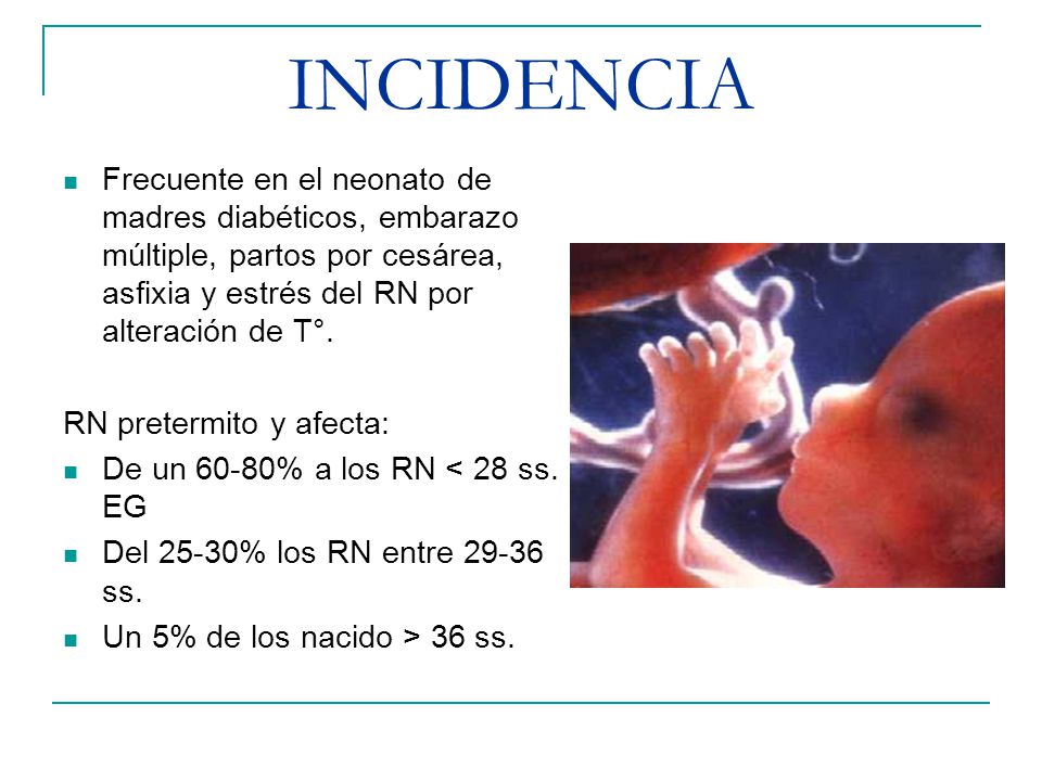 INCIDENCIA Frecuente en el neonato de madres diabéticos, embarazo múltiple, partos por cesárea, asfixia y estrés del RN por alteración de T°.