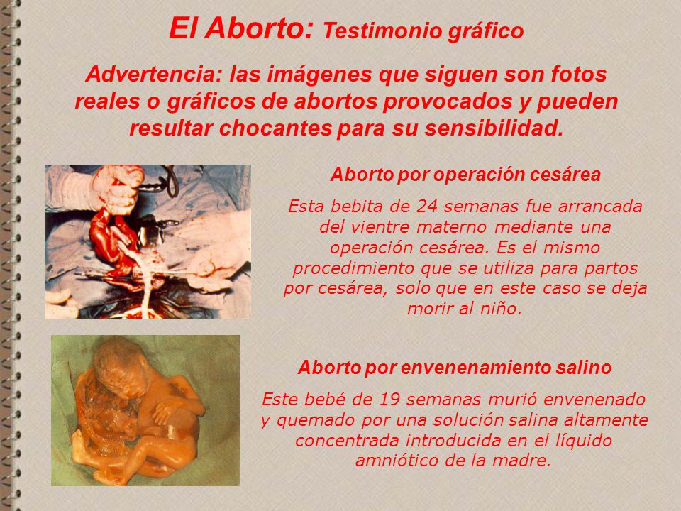 Aborto por operación cesárea Aborto por envenenamiento salino