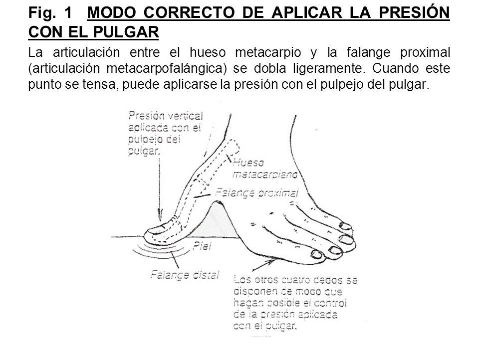 Fig. 1 MODO CORRECTO DE APLICAR LA PRESIÓN CON EL PULGAR