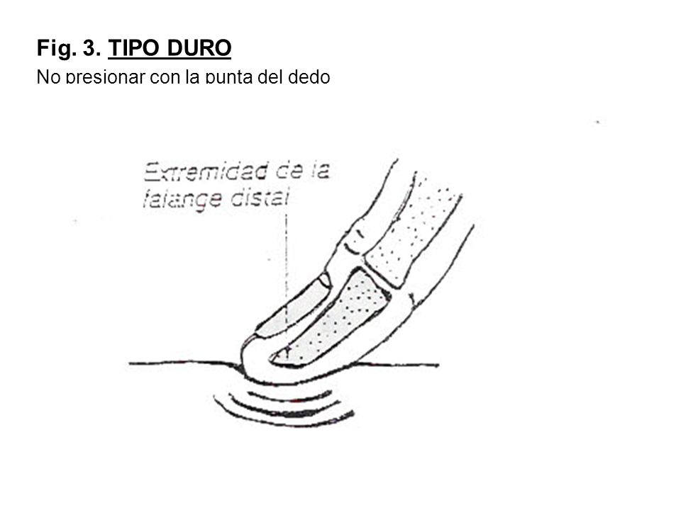 Fig. 3. TIPO DURO No presionar con la punta del dedo