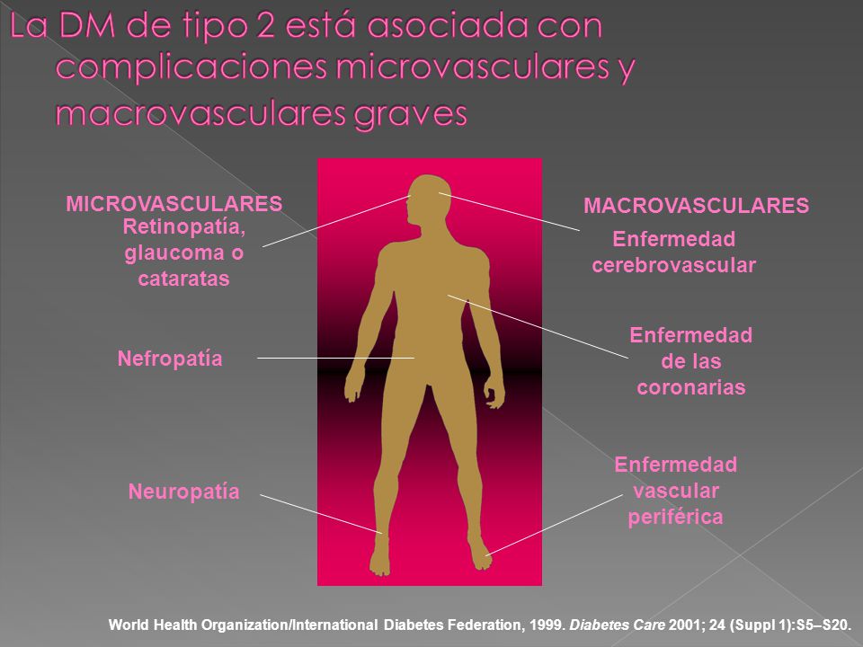 La DM de tipo 2 está asociada con complicaciones microvasculares y macrovasculares graves
