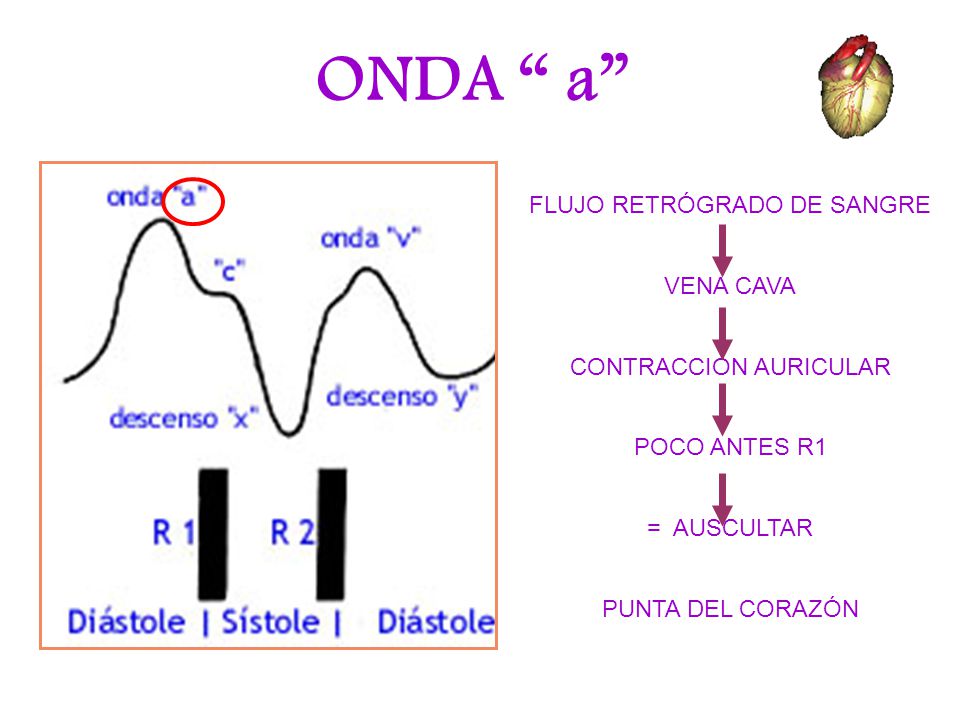ONDA a FLUJO RETRÓGRADO DE SANGRE VENA CAVA CONTRACCION AURICULAR