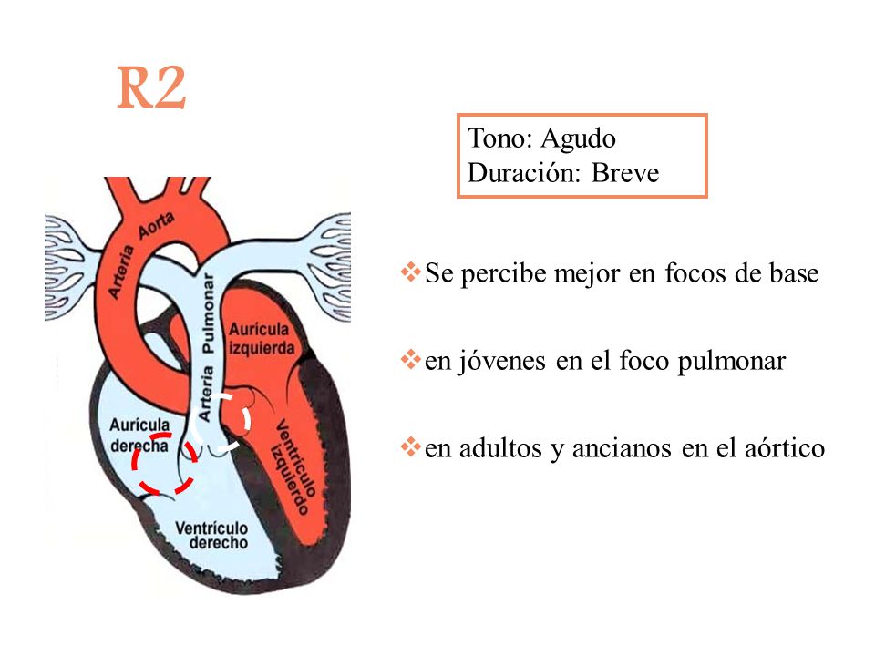 R2 Tono: Agudo Duración: Breve Se percibe mejor en focos de base