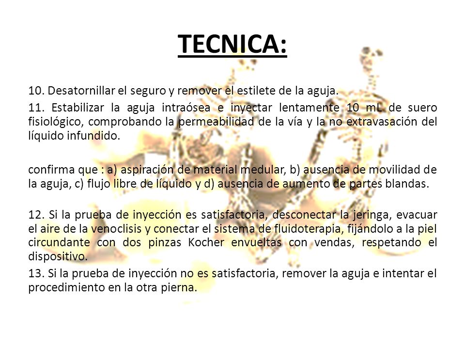 TECNICA: