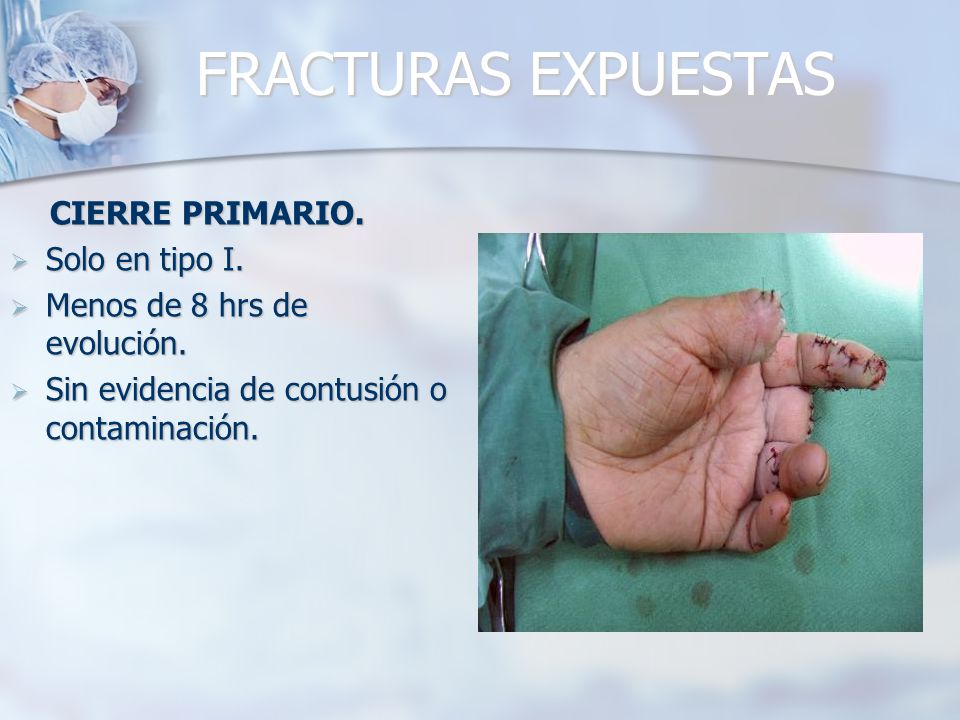 FRACTURAS EXPUESTAS CIERRE PRIMARIO. Solo en tipo I.