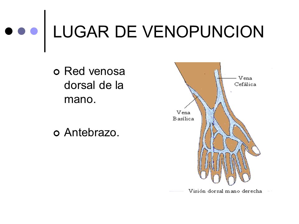 LUGAR DE VENOPUNCION Red venosa dorsal de la mano. Antebrazo.