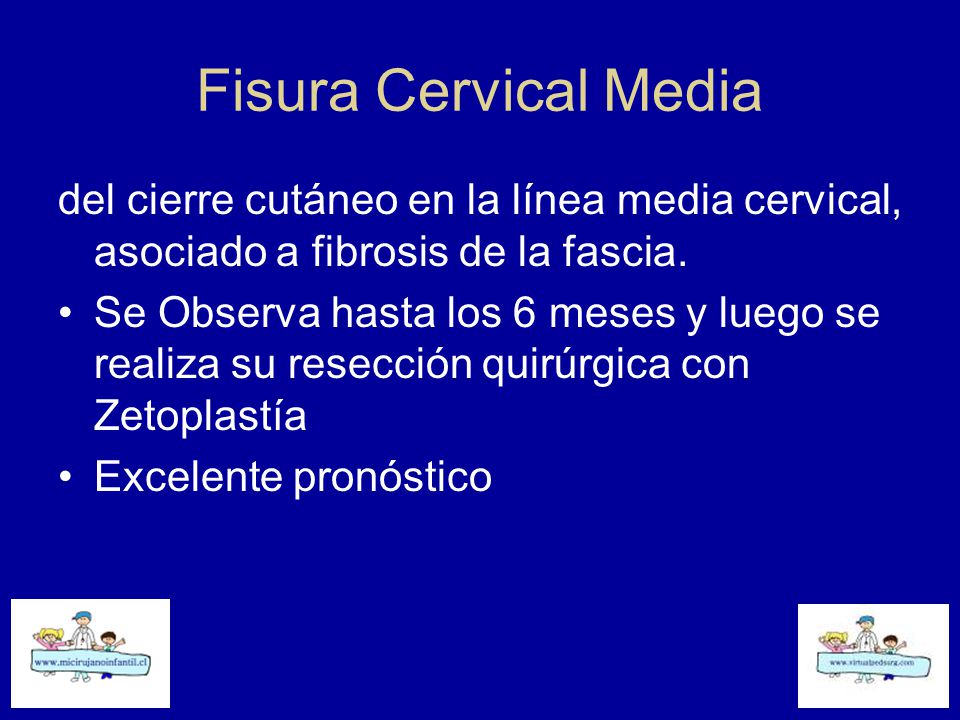 Fisura Cervical Media del cierre cutáneo en la línea media cervical, asociado a fibrosis de la fascia.