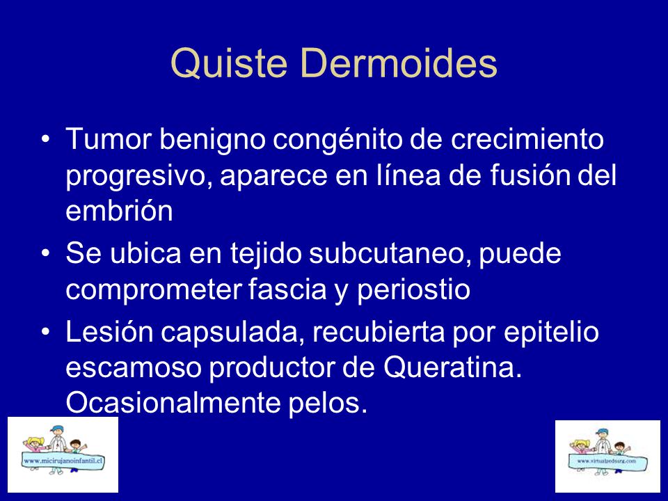 Quiste Dermoides Tumor benigno congénito de crecimiento progresivo, aparece en línea de fusión del embrión.