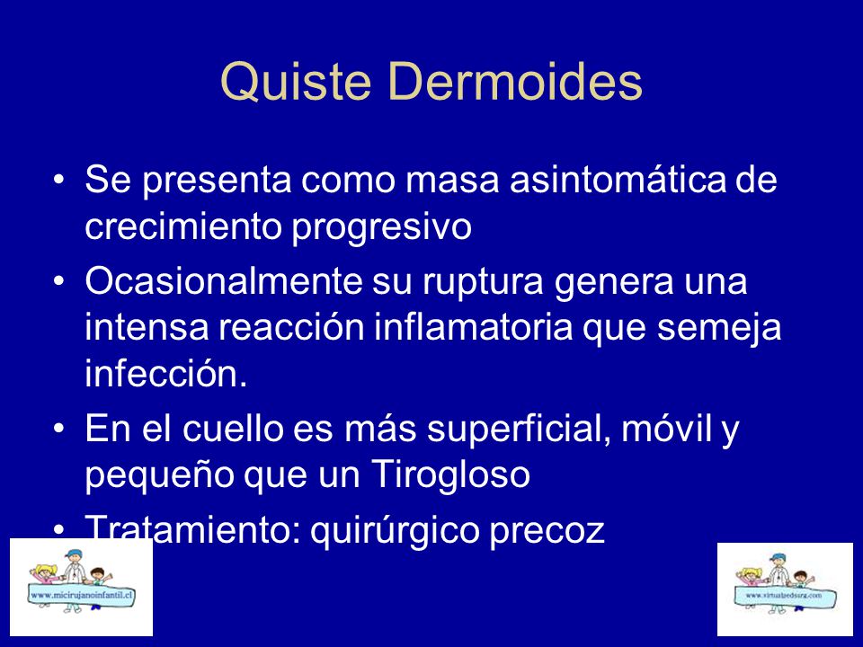 Quiste Dermoides Se presenta como masa asintomática de crecimiento progresivo.