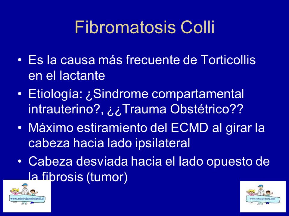 Fibromatosis Colli Es la causa más frecuente de Torticollis en el lactante. Etiología: ¿Sindrome compartamental intrauterino , ¿¿Trauma Obstétrico