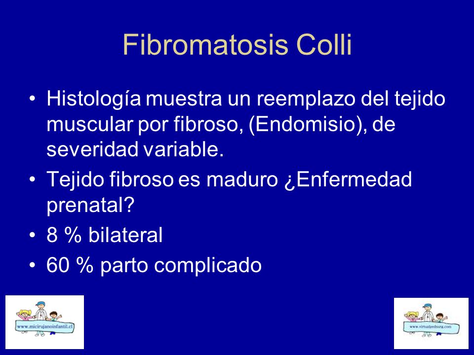 Fibromatosis Colli Histología muestra un reemplazo del tejido muscular por fibroso, (Endomisio), de severidad variable.