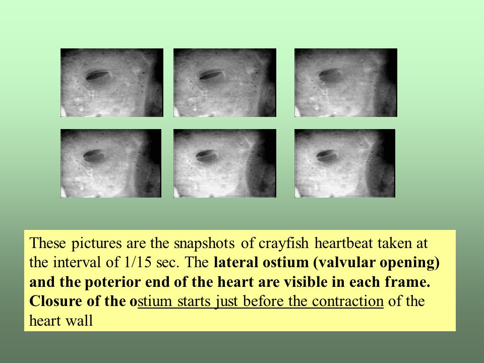 These pictures are the snapshots of crayfish heartbeat taken at the interval of 1/15 sec.