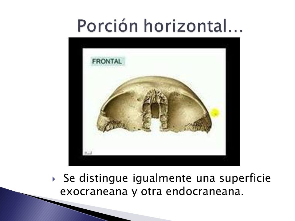 Porción horizontal… Se distingue igualmente una superficie exocraneana y otra endocraneana.